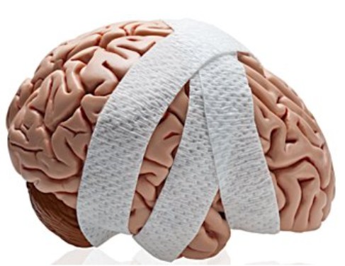 Sports brain injury prediction