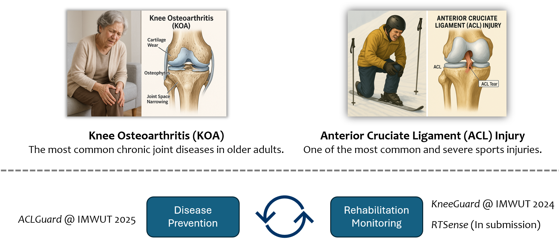 ACL-related sports activity