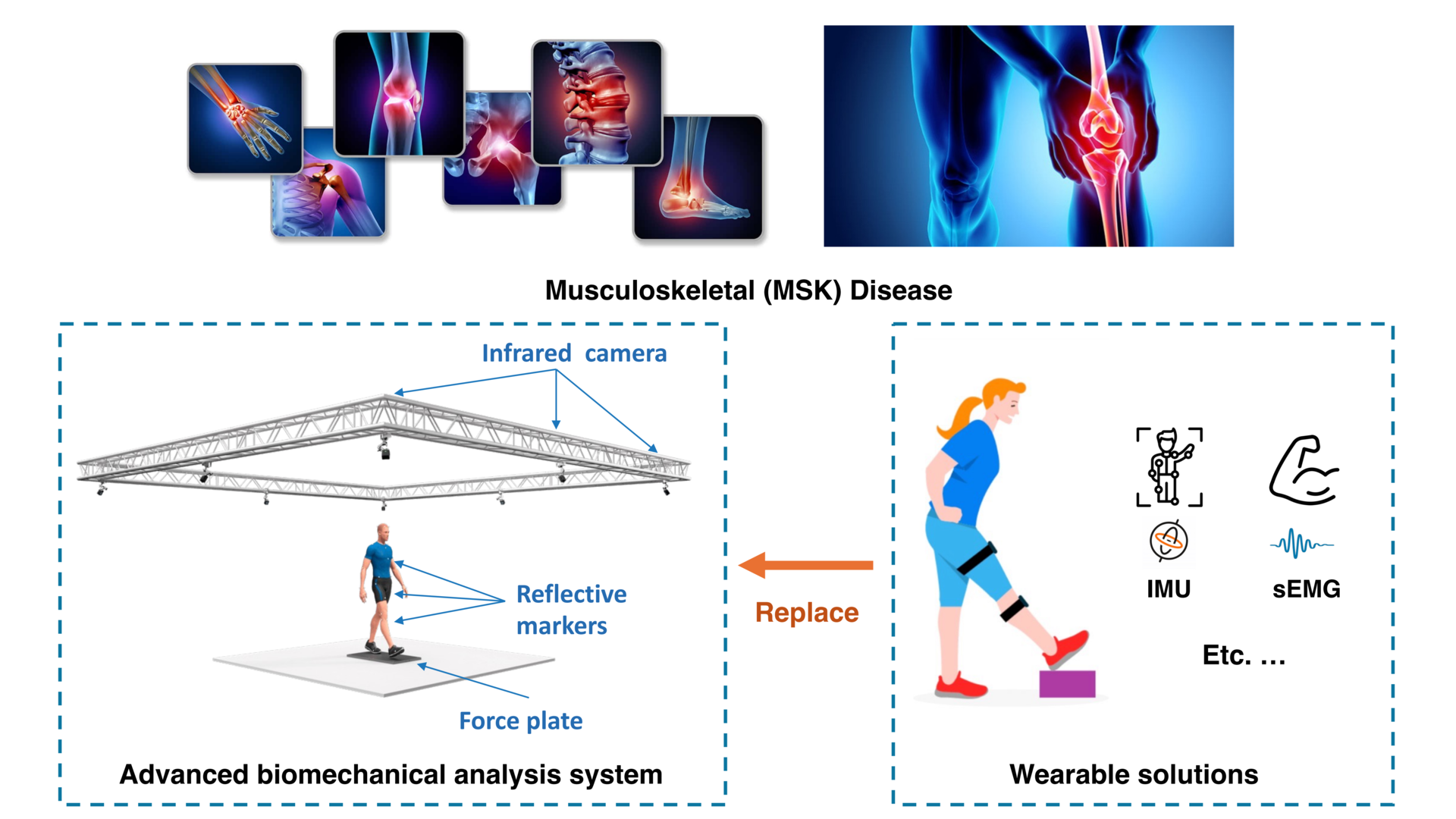 Musculoskeletal Disease Management featured image