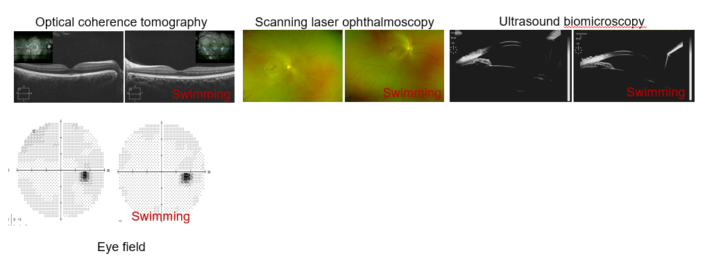 Clinical Sports Ophthalmology: participant characteristics and imaging findings